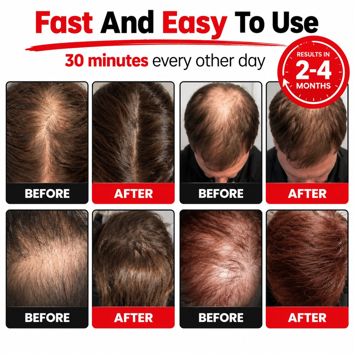 GrowCap™ Red Light Hair Growth Cap